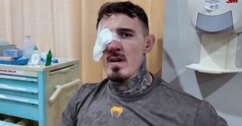 Tom Aspinall UFC 321 Injury: Champion Battles Vision Issues After No Contest